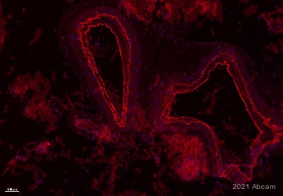 Immunohistochemistry (Formalin/PFA-fixed paraffin-embedded sections) - Anti-VEGF Receptor 3 antibody (AB27278), expandable thumbnail