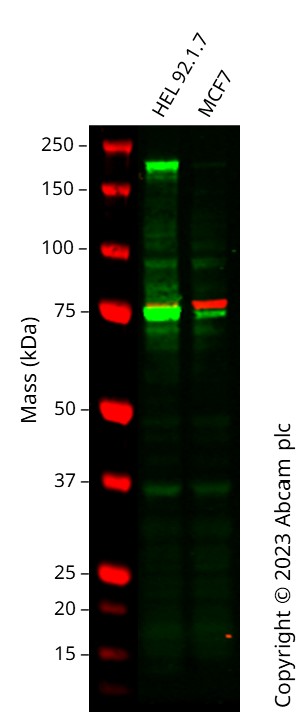 Western blot - Anti-VEGF Receptor 3 antibody [EPR22293-14] - BSA and Azide free (AB243565), expandable thumbnail