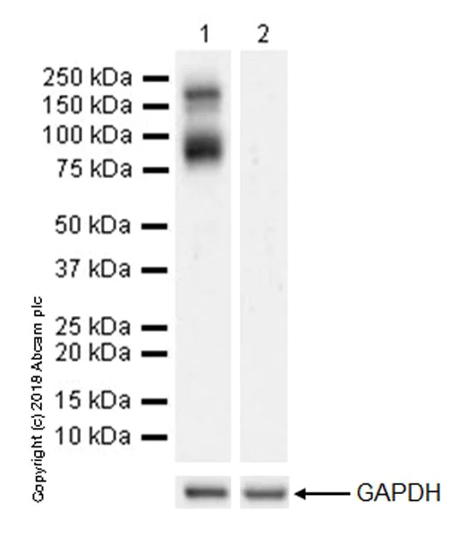 Western blot - Anti-VEGF Receptor 3 antibody [EPR22293-14] - BSA and Azide free (AB243565)