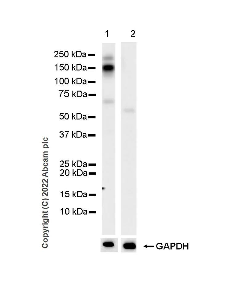 Western blot - Anti-VEGF Receptor 3 antibody [EPR24718-58] (BSA and Azide free) (AB300415)