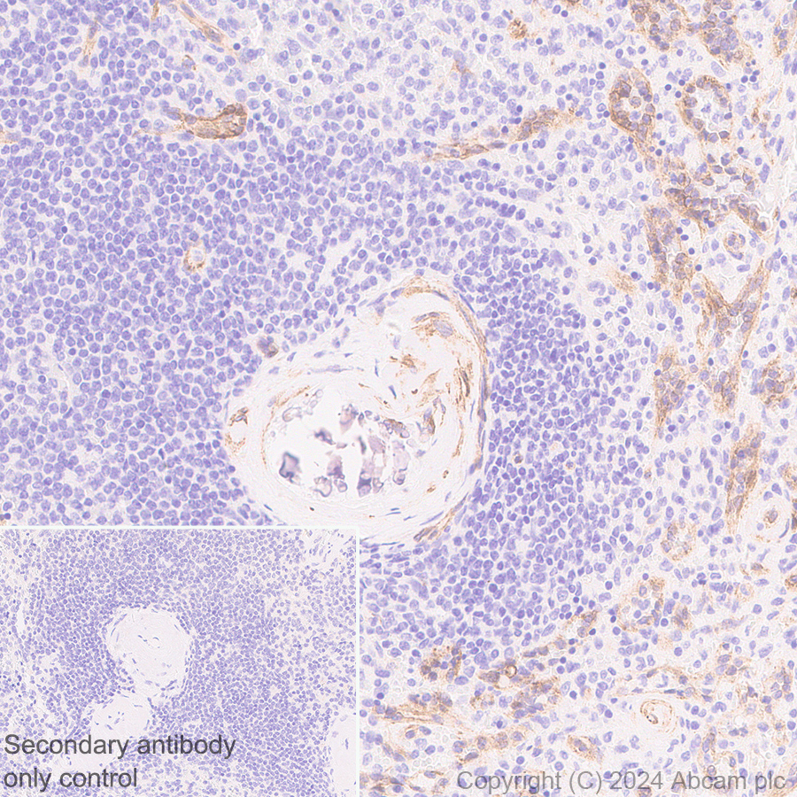 Immunohistochemistry (Formalin/PFA-fixed paraffin-embedded sections) - Anti-VEGF Receptor 3 antibody [EPR28713-56] (ab317030), expandable thumbnail
