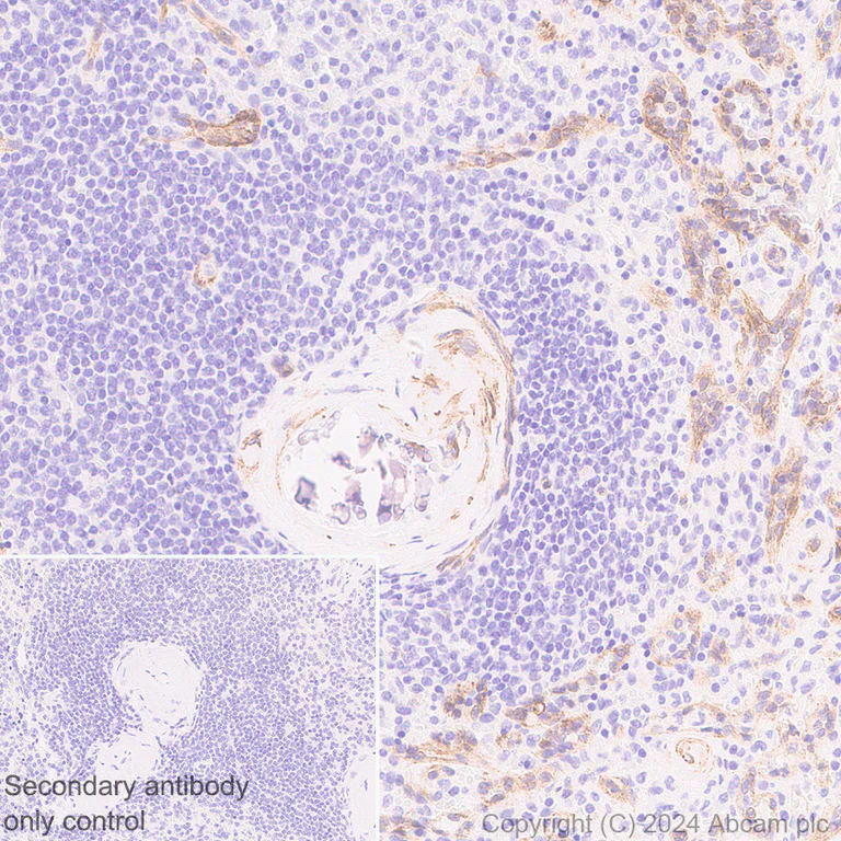 Immunohistochemistry (Formalin/PFA-fixed paraffin-embedded sections) - Anti-VEGF Receptor 3 antibody [EPR28713-56] (AB317030)