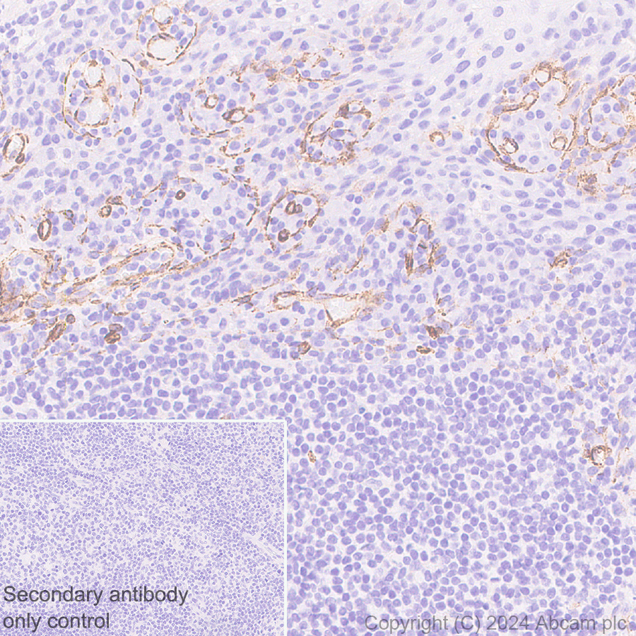 Immunohistochemistry (Formalin/PFA-fixed paraffin-embedded sections) - Anti-VEGF Receptor 3 antibody [EPR28713-56] (ab317030), expandable thumbnail