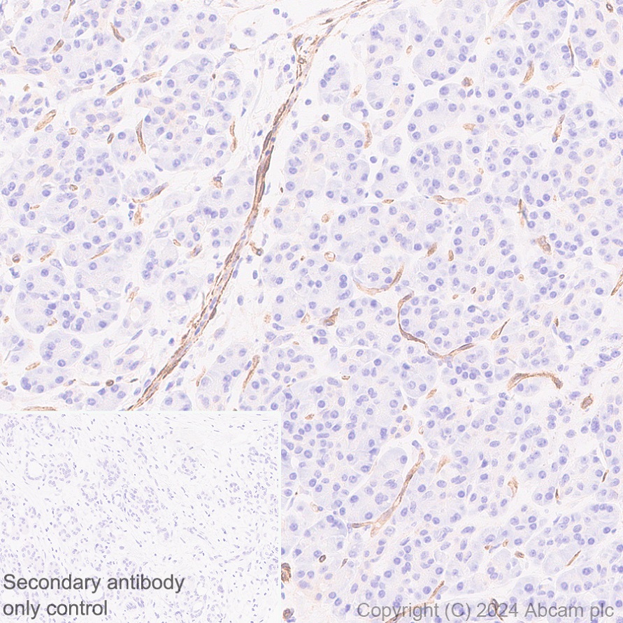Immunohistochemistry (Formalin/PFA-fixed paraffin-embedded sections) - Anti-VEGF Receptor 3 antibody [EPR28713-56] (AB317030), expandable thumbnail