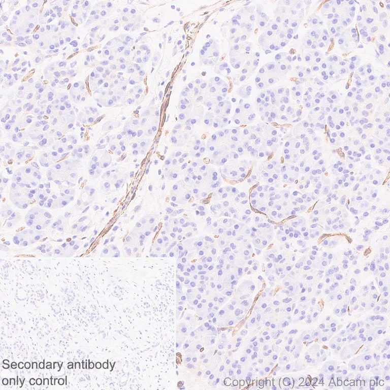 Immunohistochemistry (Formalin/PFA-fixed paraffin-embedded sections) - Anti-VEGF Receptor 3 antibody [EPR28713-56] (AB317030)
