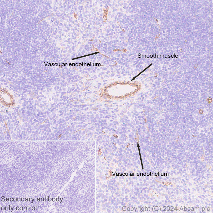 Immunohistochemistry (Formalin/PFA-fixed paraffin-embedded sections) - Anti-VEGF Receptor 3 antibody [EPR28713-56] (ab317030), expandable thumbnail