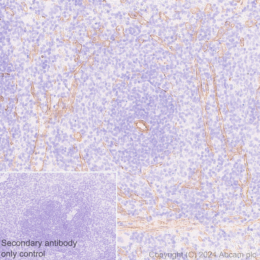 Immunohistochemistry (Formalin/PFA-fixed paraffin-embedded sections) - Anti-VEGF Receptor 3 antibody [EPR28713-56] (AB317030), expandable thumbnail