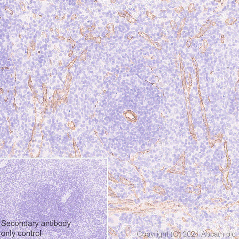 Immunohistochemistry (Formalin/PFA-fixed paraffin-embedded sections) - Anti-VEGF Receptor 3 antibody [EPR28713-56] (AB317030)