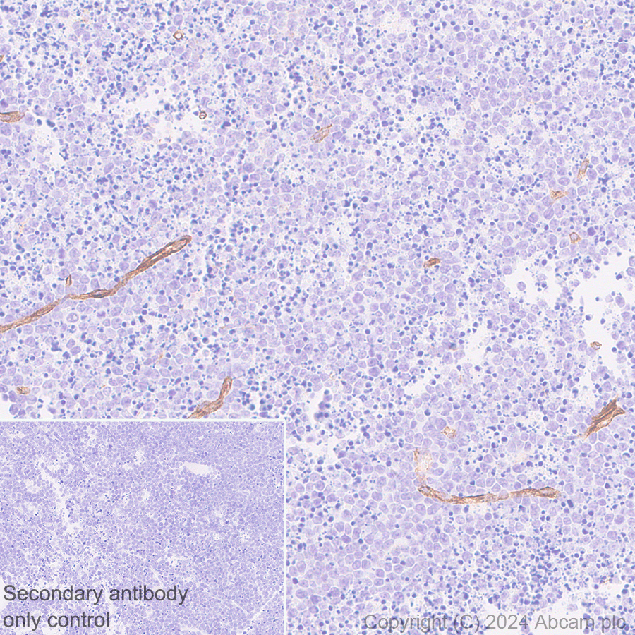 Immunohistochemistry (Formalin/PFA-fixed paraffin-embedded sections) - Anti-VEGF Receptor 3 antibody [EPR28713-56] (AB317030), expandable thumbnail