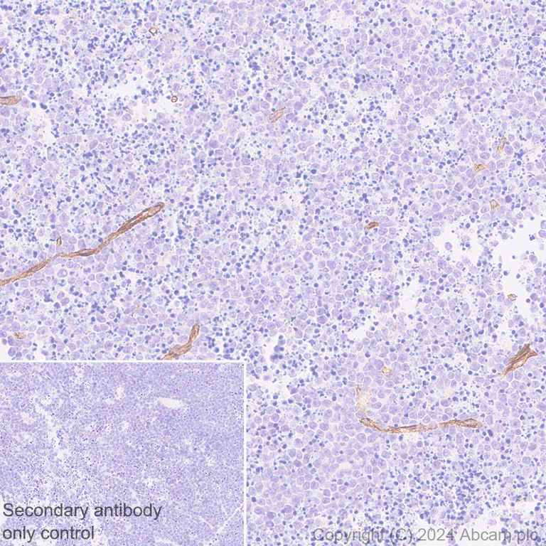 Immunohistochemistry (Formalin/PFA-fixed paraffin-embedded sections) - Anti-VEGF Receptor 3 antibody [EPR28713-56] (AB317030)
