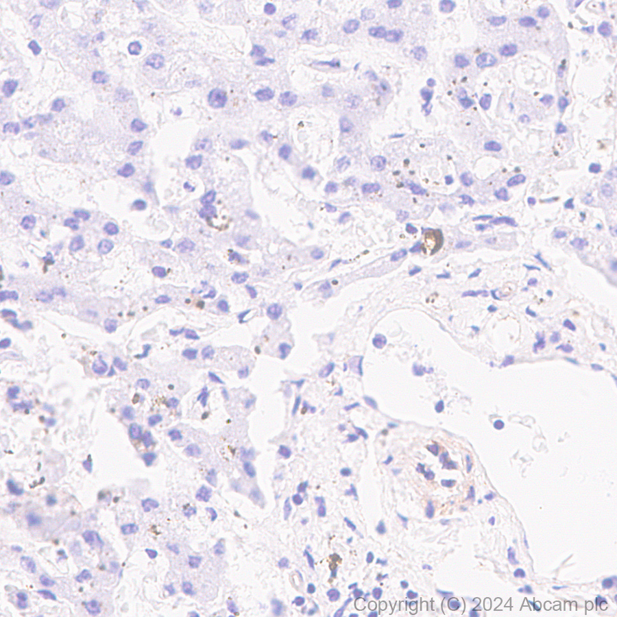 Immunohistochemistry (Formalin/PFA-fixed paraffin-embedded sections) - Anti-VEGF Receptor 3 antibody [EPR28713-56] (AB317030), expandable thumbnail