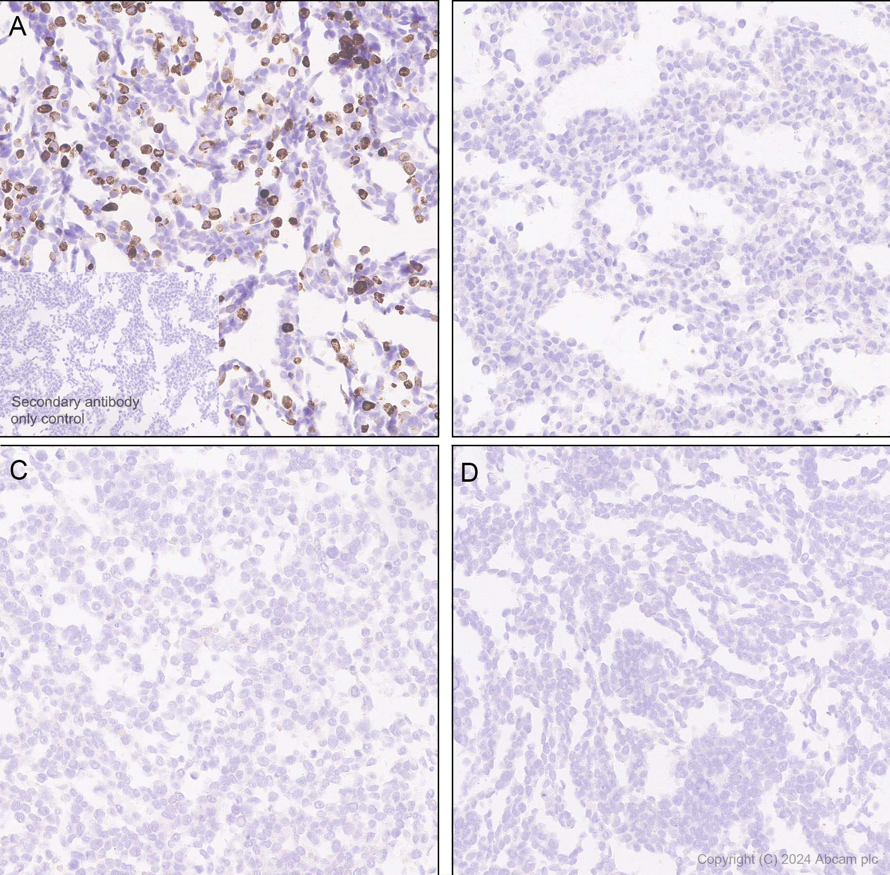 Immunohistochemistry (Formalin/PFA-fixed paraffin-embedded sections) - Anti-VEGF Receptor 3 antibody [EPR28713-56] (AB317030), expandable thumbnail