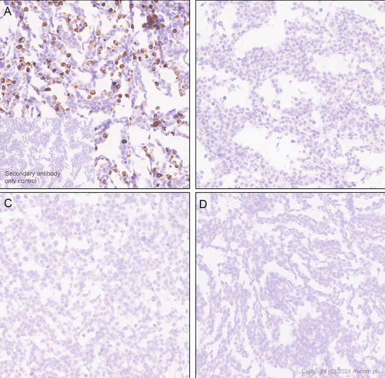 Immunohistochemistry (Formalin/PFA-fixed paraffin-embedded sections) - Anti-VEGF Receptor 3 antibody [EPR28713-56] (AB317030)
