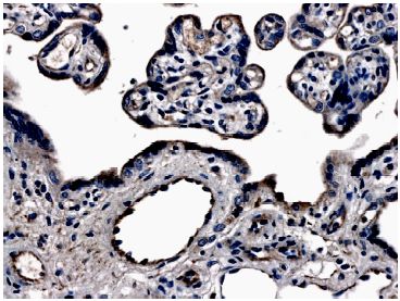 Immunohistochemistry (Formalin/PFA-fixed paraffin-embedded sections) - Anti-VEGF Receptor 3 antibody [MM0003-7G63] (AB51496), expandable thumbnail