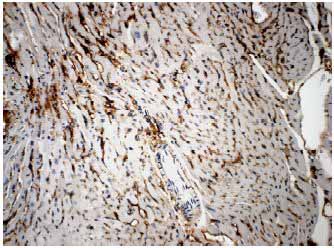 Immunohistochemistry paraffin embedded sections - Anti-VEGF Receptor 3 antibody [RM0003-5F63] (AB51874), expandable thumbnail