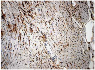 Immunohistochemistry paraffin embedded sections - Anti-VEGF Receptor 3 antibody [RM0003-5F63] (AB51874)