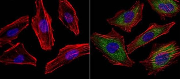 Immunocytochemistry - Anti-VEGFA antibody [16F1] (AB155944), expandable thumbnail