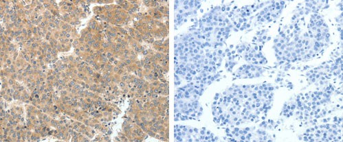 Immunohistochemistry (Formalin/PFA-fixed paraffin-embedded sections) - Anti-VEGFA antibody (AB183100), expandable thumbnail