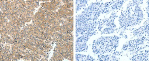 Immunohistochemistry (Formalin/PFA-fixed paraffin-embedded sections) - Anti-VEGFA antibody (AB183100)