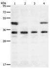 Western blot - Anti-VEGFA antibody (AB183100), expandable thumbnail