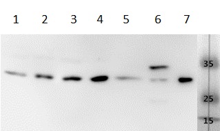 Western blot - Anti-VEGFA antibody (AB183100), expandable thumbnail