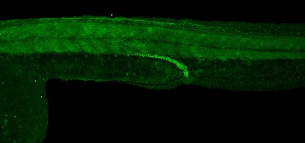 IHC - Wholemount - Anti-VEGFA antibody (AB209835), expandable thumbnail