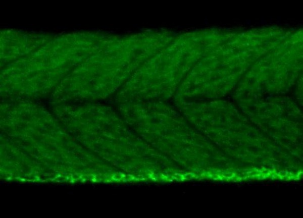 IHC - Wholemount - Anti-VEGFA antibody (AB209835), expandable thumbnail