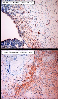 Immunohistochemistry (Formalin/PFA-fixed paraffin-embedded sections) - Anti-VEGFA antibody (AB51745), expandable thumbnail