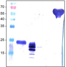 Western blot - Anti-VEGFA antibody (AB51745), expandable thumbnail