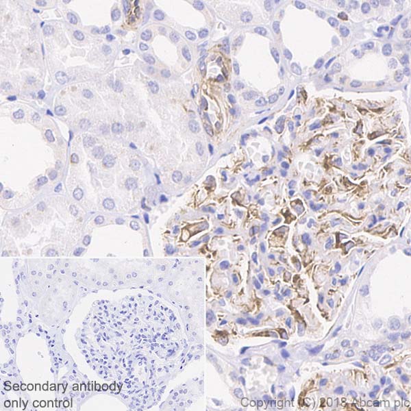 Immunohistochemistry (Formalin/PFA-fixed paraffin-embedded sections) - Anti-VEGFA antibody [EP1176Y] - BSA and Azide free (AB185238), expandable thumbnail