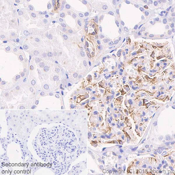 Immunohistochemistry (Formalin/PFA-fixed paraffin-embedded sections) - Anti-VEGFA antibody [EP1176Y] - BSA and Azide free (AB185238)