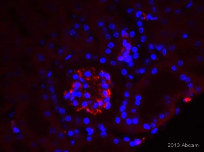 Immunohistochemistry (Formalin/PFA-fixed paraffin-embedded sections) - Anti-VEGFA antibody [EP1176Y] - BSA and Azide free (AB185238)