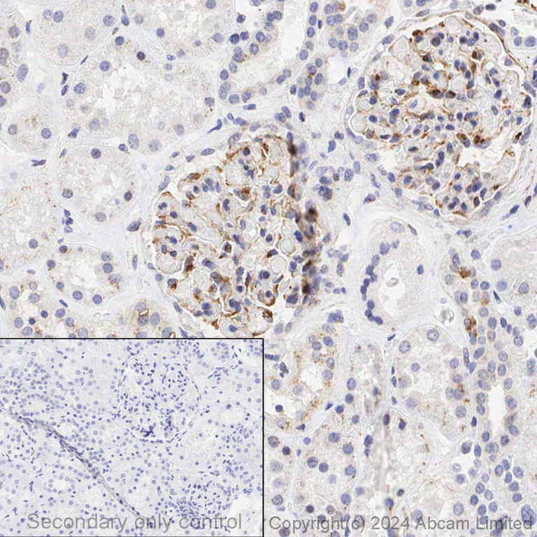 Immunohistochemistry (Formalin/PFA-fixed paraffin-embedded sections) - Anti-VEGFA antibody [EP1176Y] - BSA and Azide free (AB185238)