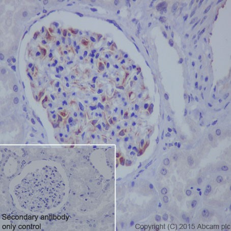 Immunohistochemistry (Formalin/PFA-fixed paraffin-embedded sections) - Anti-VEGFA antibody [EP1176Y] - BSA and Azide free (ab185238), expandable thumbnail