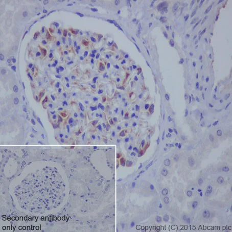 Immunohistochemistry (Formalin/PFA-fixed paraffin-embedded sections) - Anti-VEGFA antibody [EP1176Y] - BSA and Azide free (AB185238)