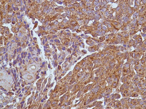 Immunohistochemistry (Formalin/PFA-fixed paraffin-embedded sections) - Anti-VEGFA antibody [SP28], prediluted (AB27620)