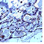 Immunohistochemistry (Formalin/PFA-fixed paraffin-embedded sections) - Anti-VEGFA antibody [SP28], prediluted (AB27620)