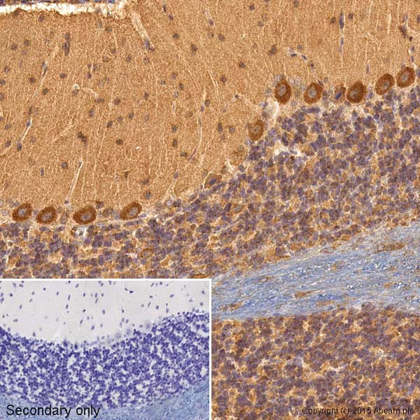 Immunohistochemistry (Formalin/PFA-fixed paraffin-embedded sections) - Anti-VEGFA antibody [VG-1] (AB1316)