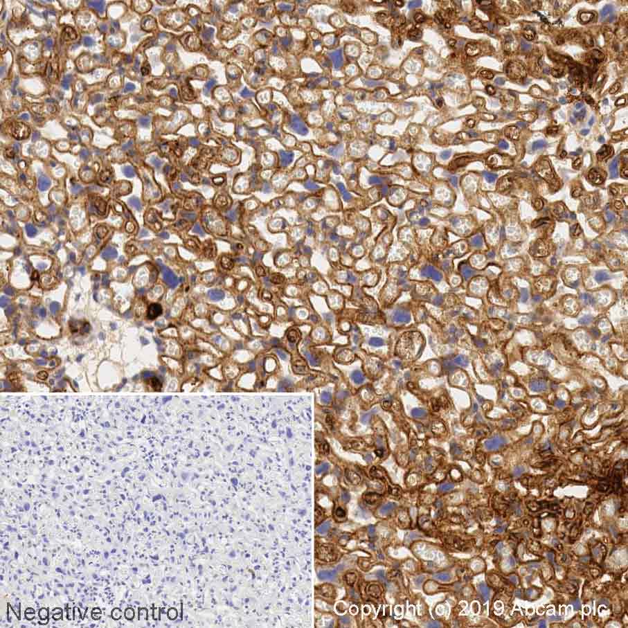 Immunohistochemistry (Formalin/PFA-fixed paraffin-embedded sections) - Anti-VEGFA antibody [VG-1] (AB1316)