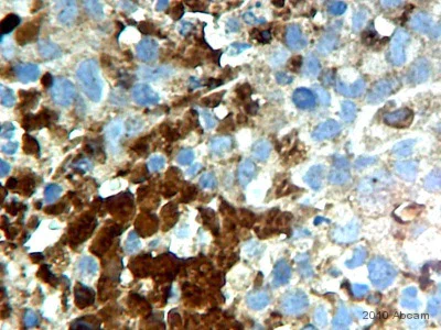 Immunohistochemistry (Formalin/PFA-fixed paraffin-embedded sections) - Anti-VEGFA antibody [VG-1] (AB1316)