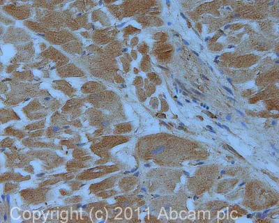 Immunohistochemistry (Formalin/PFA-fixed paraffin-embedded sections) - Anti-VEGFA antibody [VG-1] (AB1316)