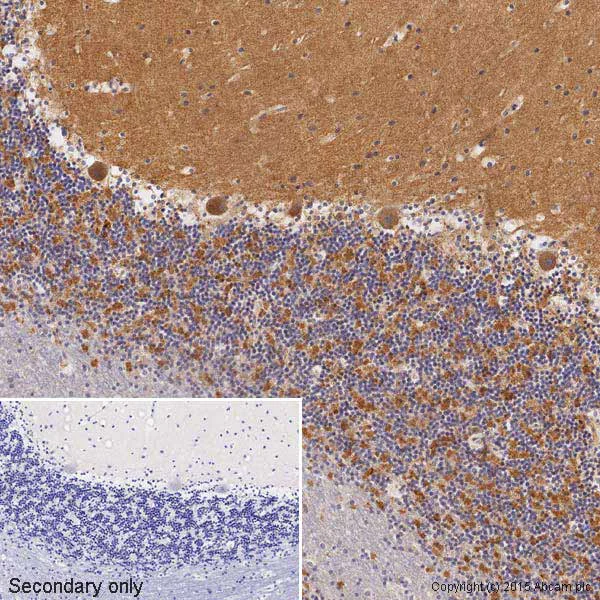 Immunohistochemistry (Formalin/PFA-fixed paraffin-embedded sections) - Anti-VEGFA antibody [VG-1] (AB1316)