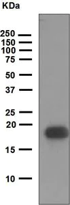 Western blot - Anti-VEGFB antibody [EPR4555] (AB110649)