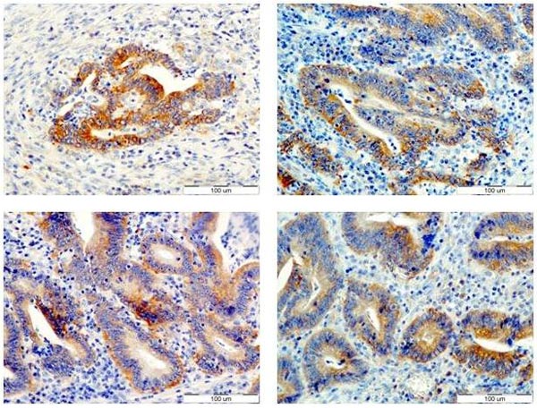 Immunohistochemistry (Formalin/PFA-fixed paraffin-embedded sections) - Anti-VEGFC antibody [9/E7] (AB106512)