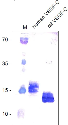 Western blot - Anti-VEGFC antibody (AB9546)