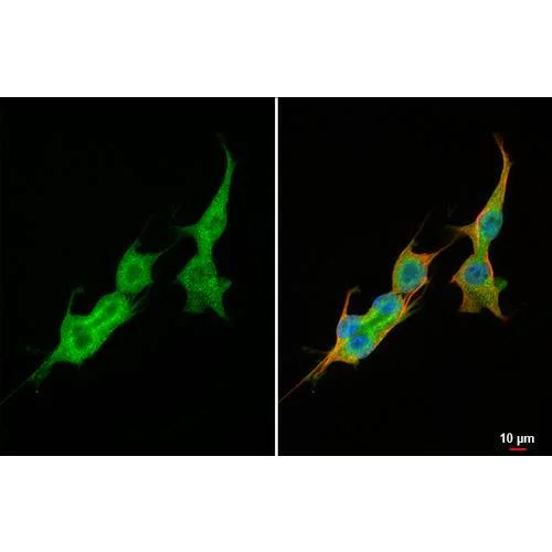 Immunocytochemistry/ Immunofluorescence - Anti-VEGFC antibody [HL2289] (AB317189)