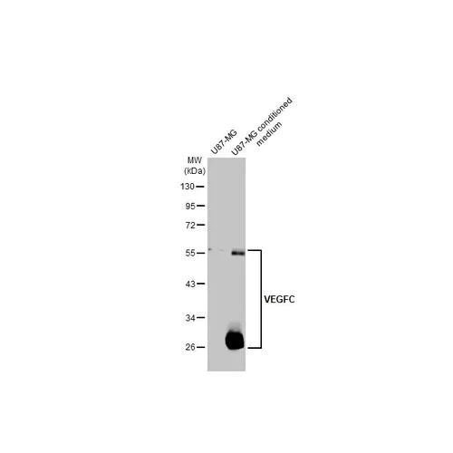 Western blot - Anti-VEGFC antibody [HL2289] (AB317189)