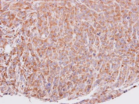 Immunohistochemistry (Formalin/PFA-fixed paraffin-embedded sections) - Anti-VEGFD antibody (AB137368)