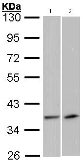 Western blot - Anti-VEGFD antibody (AB137368)