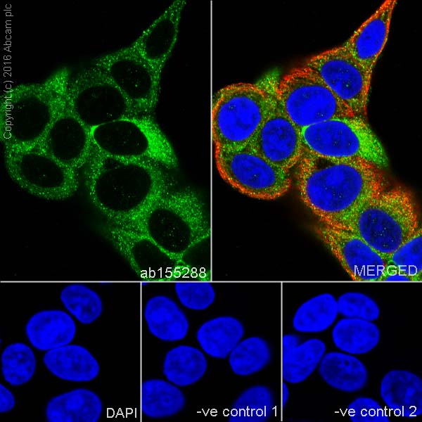 Immunocytochemistry/ Immunofluorescence - Anti-VEGFD antibody [EPR8457] (AB155288), expandable thumbnail